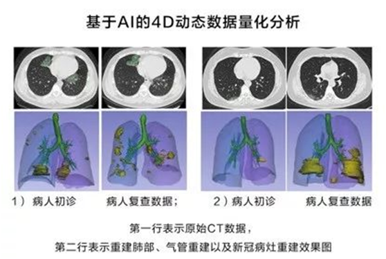 非常時期下的城市防控、生產(chǎn)與治理，華為云用AI“全鏈條“戰(zhàn)疫