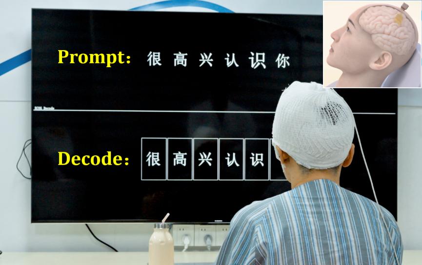 腦虎科技高通量植入式柔性腦機接口臨床試驗取得重大突破