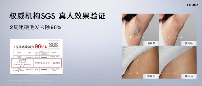 全球銷量第一的脫毛儀品牌Ulike發(fā)布超級(jí)脫毛技術(shù) 或?qū)?shí)現(xiàn)永久脫毛